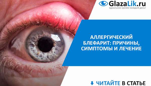 симптомы и лечение аллергического блефарита